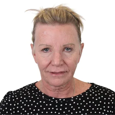 Close-up portrait of a woman in a polka dot blouse.