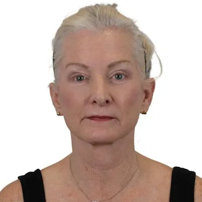A middle-aged woman with light blonde hair and neutral makeup.