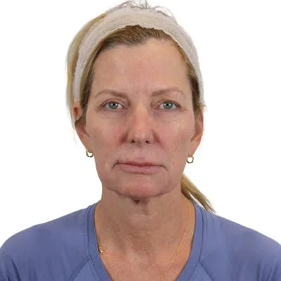 Woman's close-up portrait with natural features.