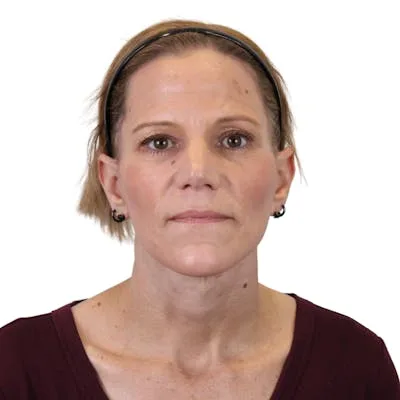 A woman with short hair facing the camera.