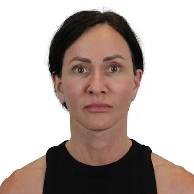 A woman with shoulder-length dark hair wearing a black top.