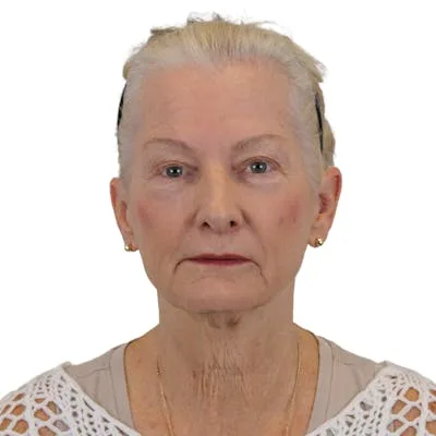 A senior woman with light hair and a neutral expression.