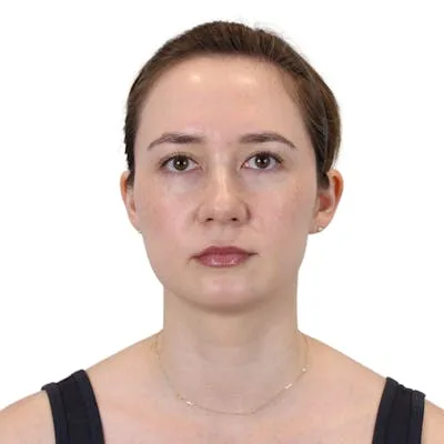 A woman showcasing a deep neck lift procedure.