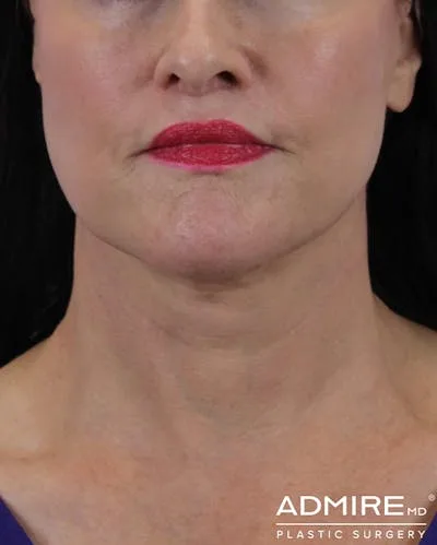 Close-up of a woman's lips and chin with red lipstick.