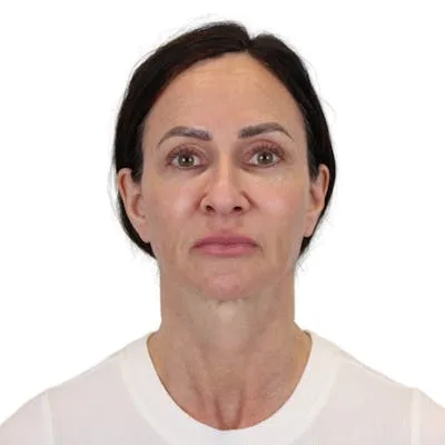 A woman with dark hair and a neutral expression on a white background.