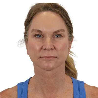 A woman in a blue tank top with light skin and brown hair.