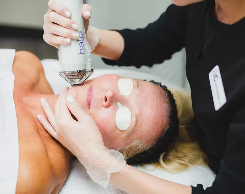 A woman undergoing facial treatment at a medspa.