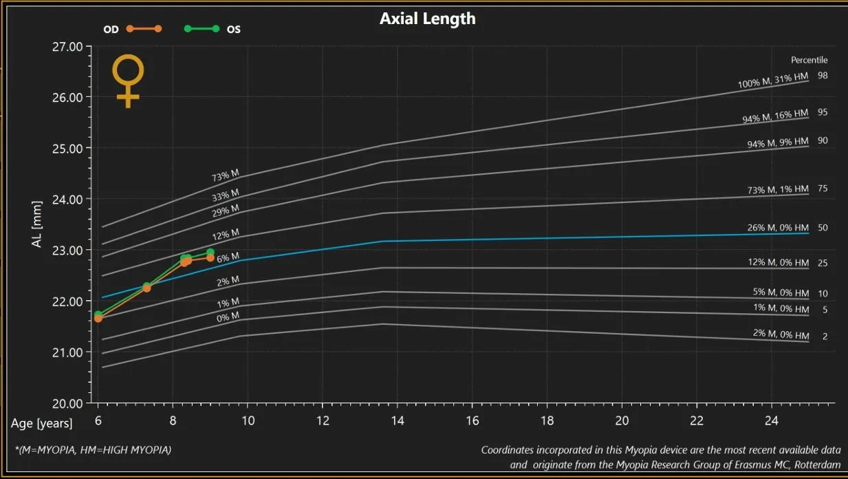 Graph showing axial length growth and myopia risk over time.
