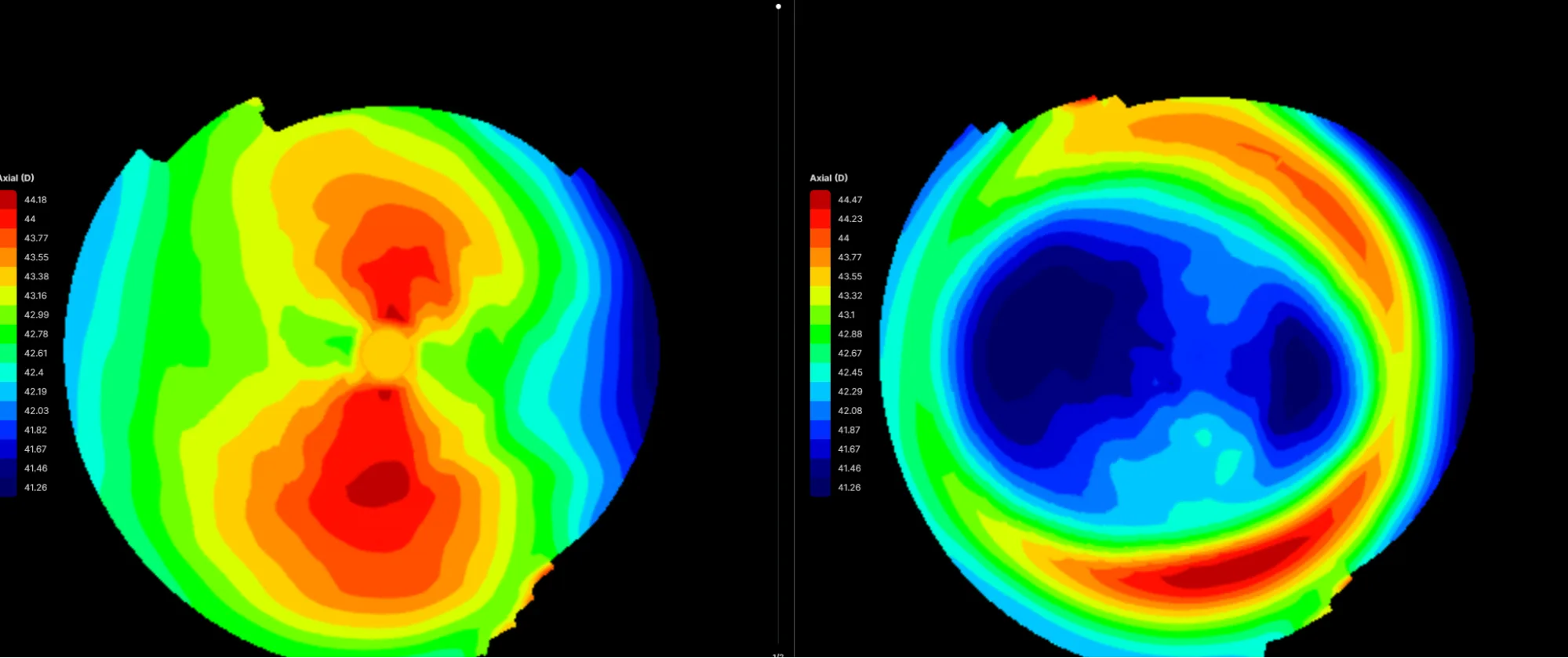 Corneal topography maps before and after orthokeratology treatment.