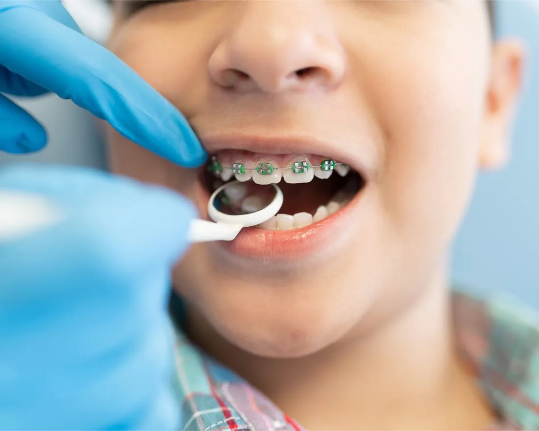 A boy with braces receiving dental treatment.