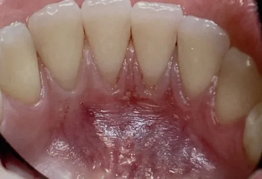 Close-up view of healthy teeth and gums.