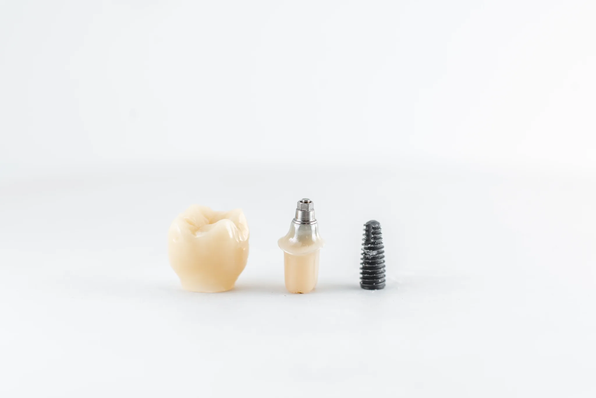 Dental implant system components: crown, abutment, and screw.