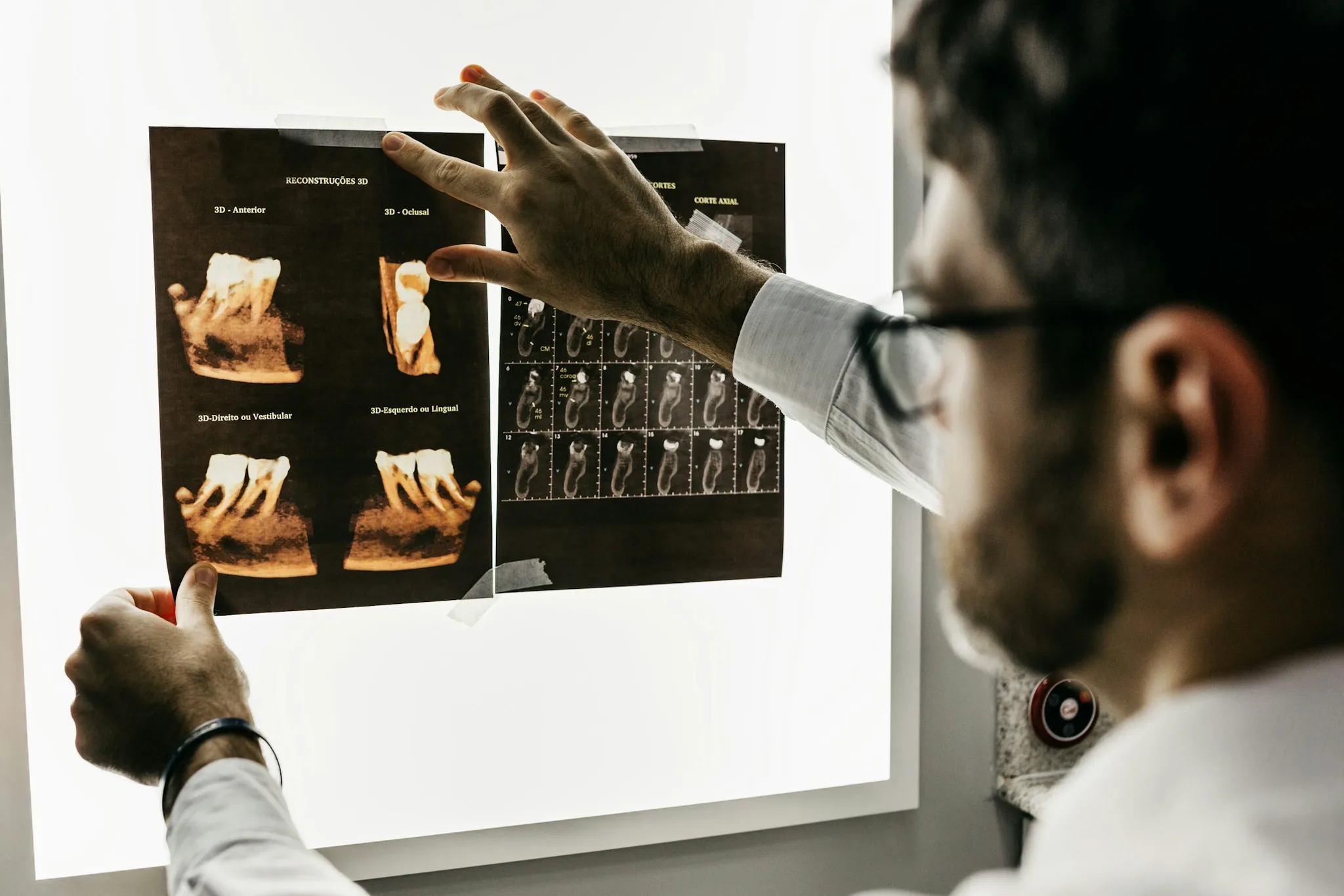 A dentist reviewing dental X-rays on a lightbox.