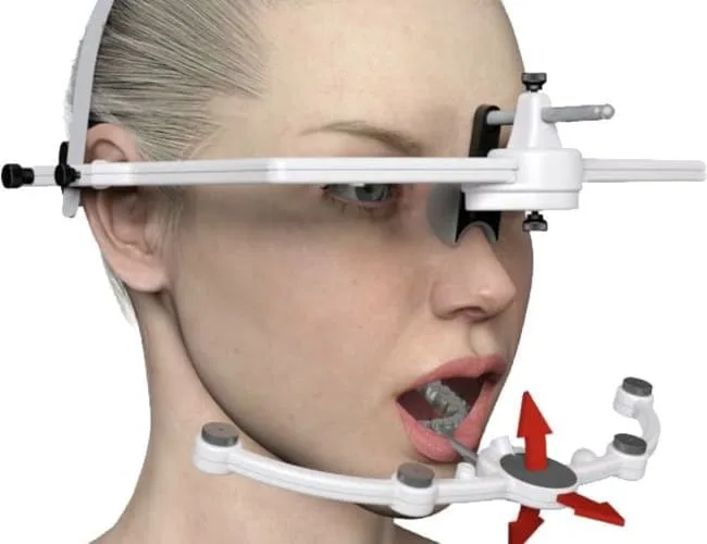 Illustration of a dental examination device on a facial model.