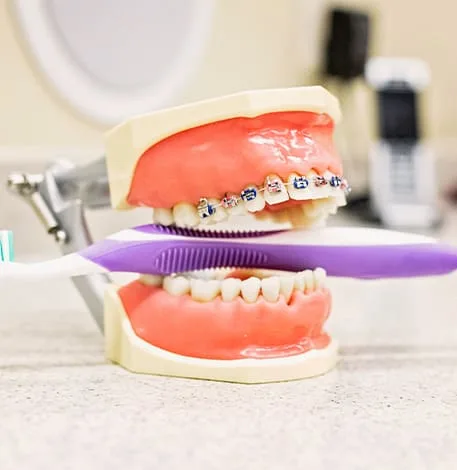 Dental model with braces and a toothbrush