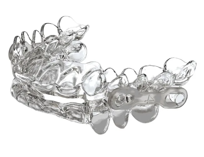 Clear dental aligner for orthodontic treatment.
