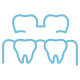Illustration of two teeth connected by a dental bridge.