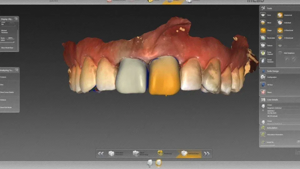 Digital dental model rendering with user interface tools