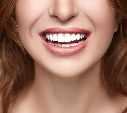 A woman smiling with perfect white teeth.