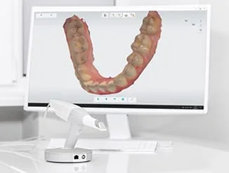 3D dental arch model displayed on a computer screen.