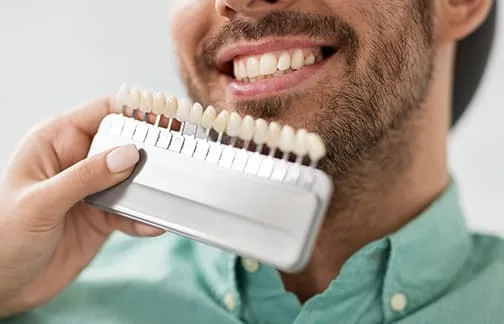 Man holding a teeth whitening shade guide and smiling.