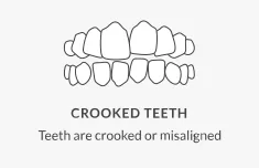 Illustration of crooked teeth with a description.