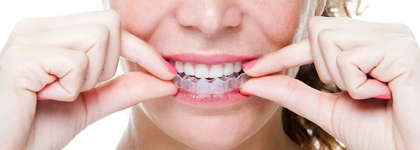 Person holding clear aligner showing straight teeth.